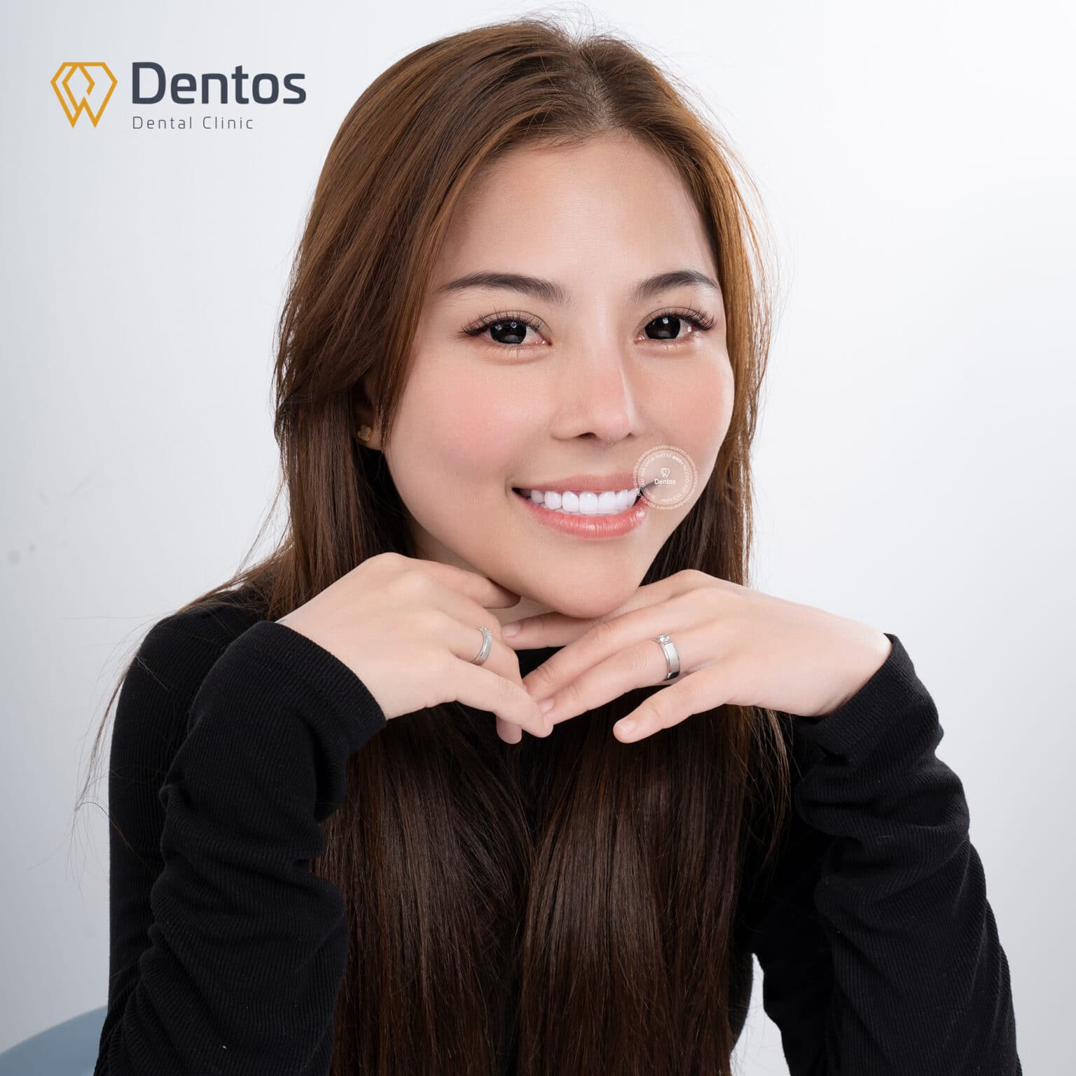 Bọc răng sứ có đau không? - Không đau mà chỉ ê nhẹ